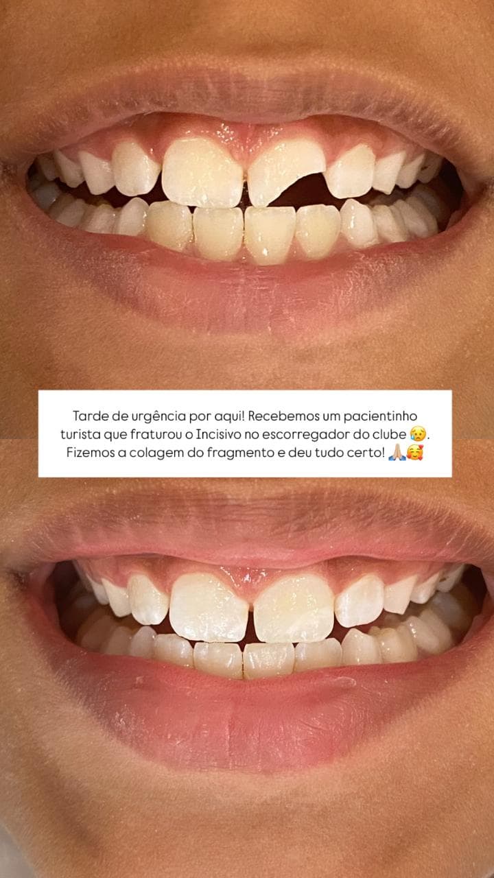 Resultado antes e depois do tratamento